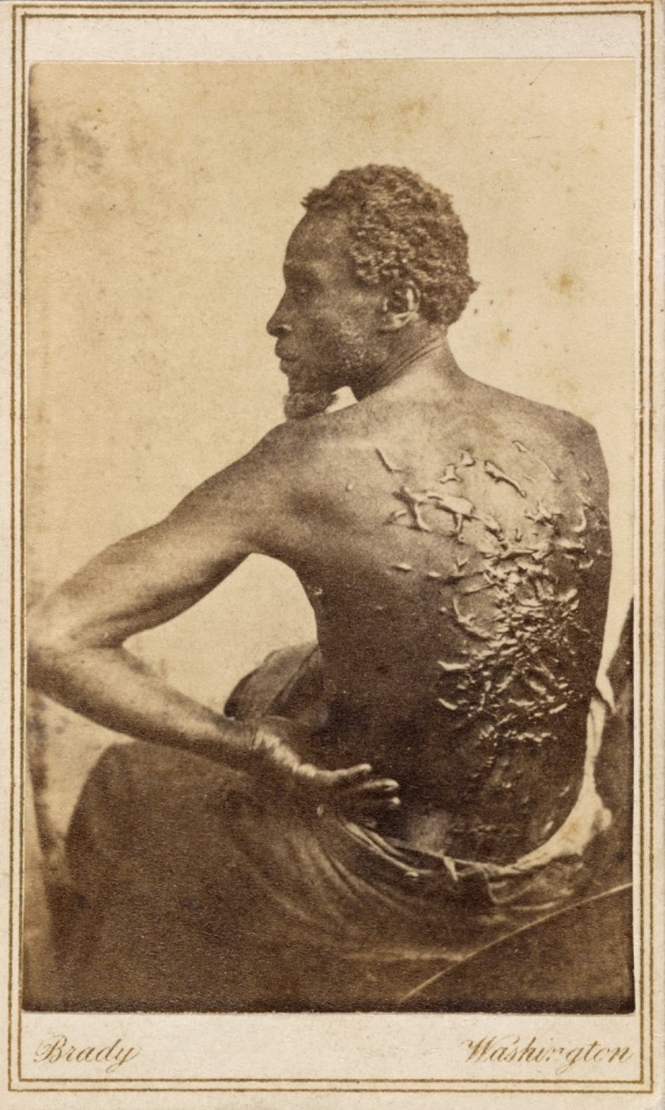 Gordon, scourged back, 1863